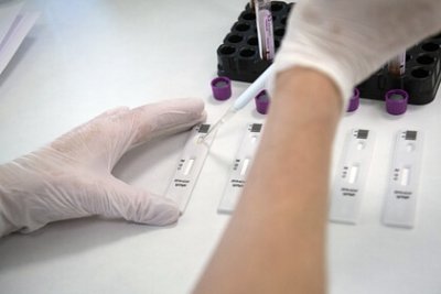 Москвичам будут делать бесплатные тесты на антитела