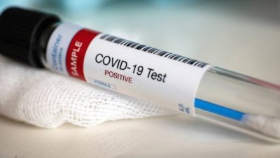 В России изменяется порядок сдачи тестов на коронавирус